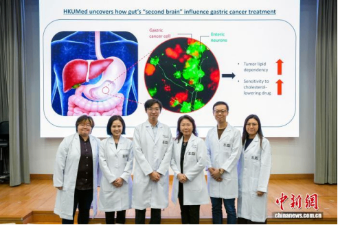 港大医学院破解胃癌&ldquo;代谢密码&rdquo; 可令肿瘤生长延缓65%